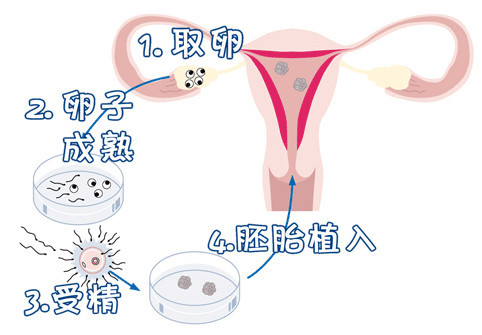 沪上生殖医学中心